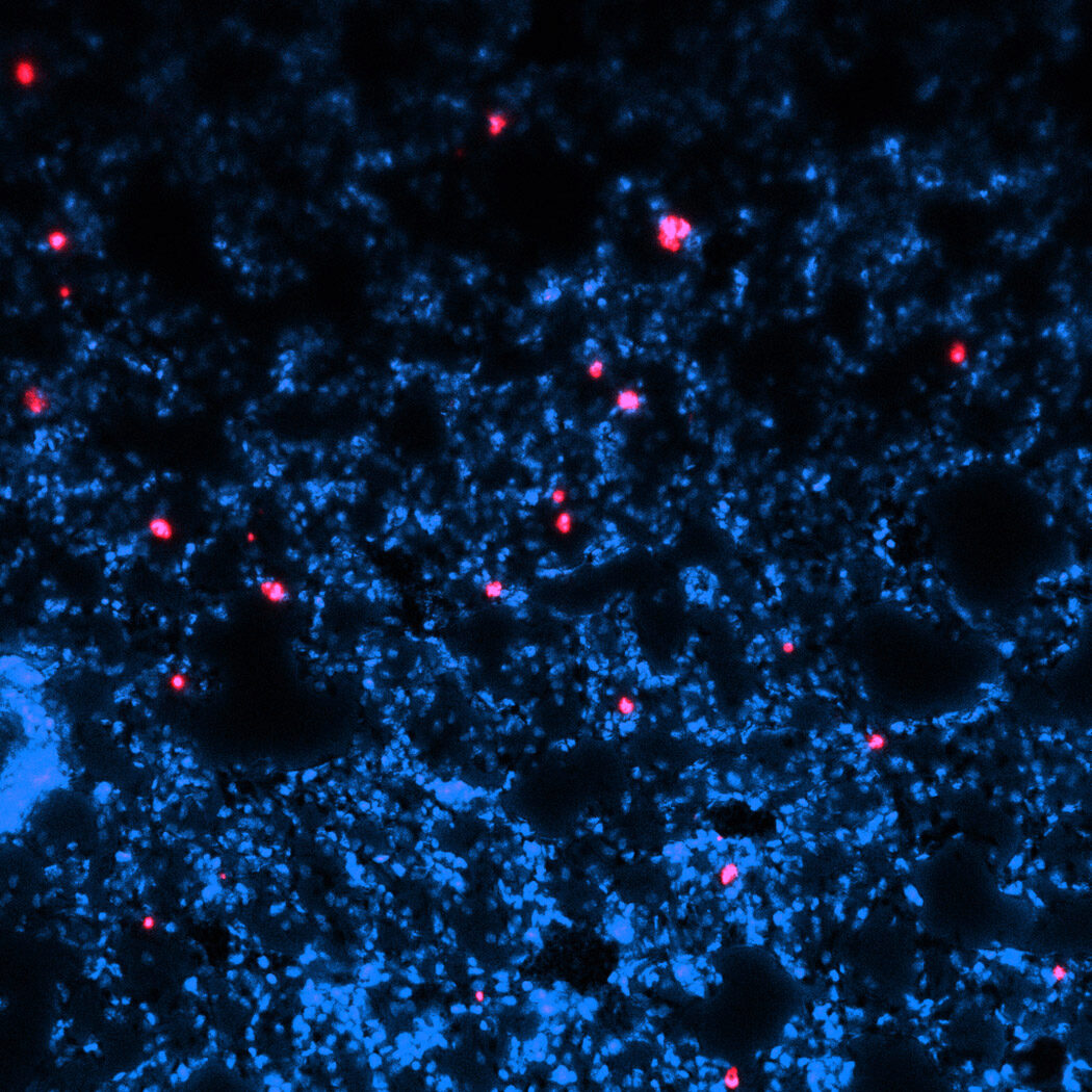 Image shows a histological section of the mouse lung showing lung cells, with DNA stained blue and microparticles shown in pink. (Credit: Rachit Agarwal Garcia Laboratory)