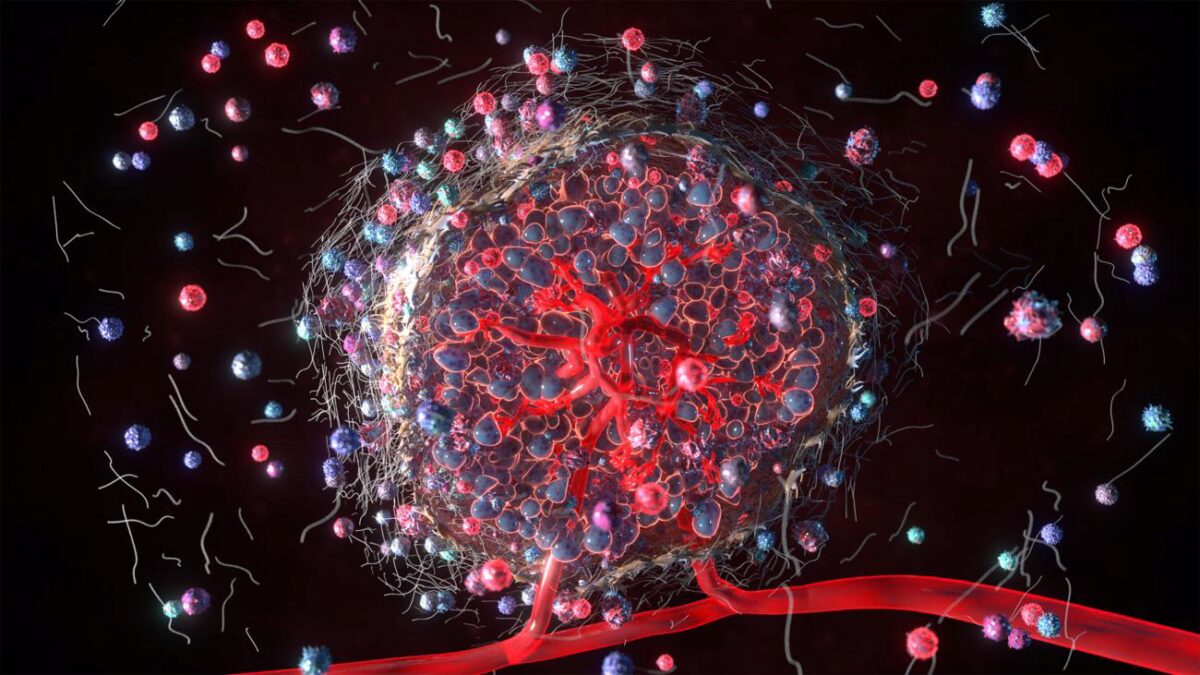 Tumor microenvironment: Ankur Singh and Jean Koff want to understand what's happening at the biomolecular to create cancer disparities.  