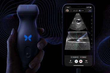 Butterfly Network