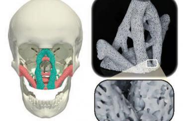  new materials could have applications for reconstructive surgery and other fields