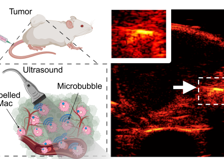 Researchers Use Air-Tagged Macrophages to Transform Cancer Imaging, Diagnosis, and Treatment