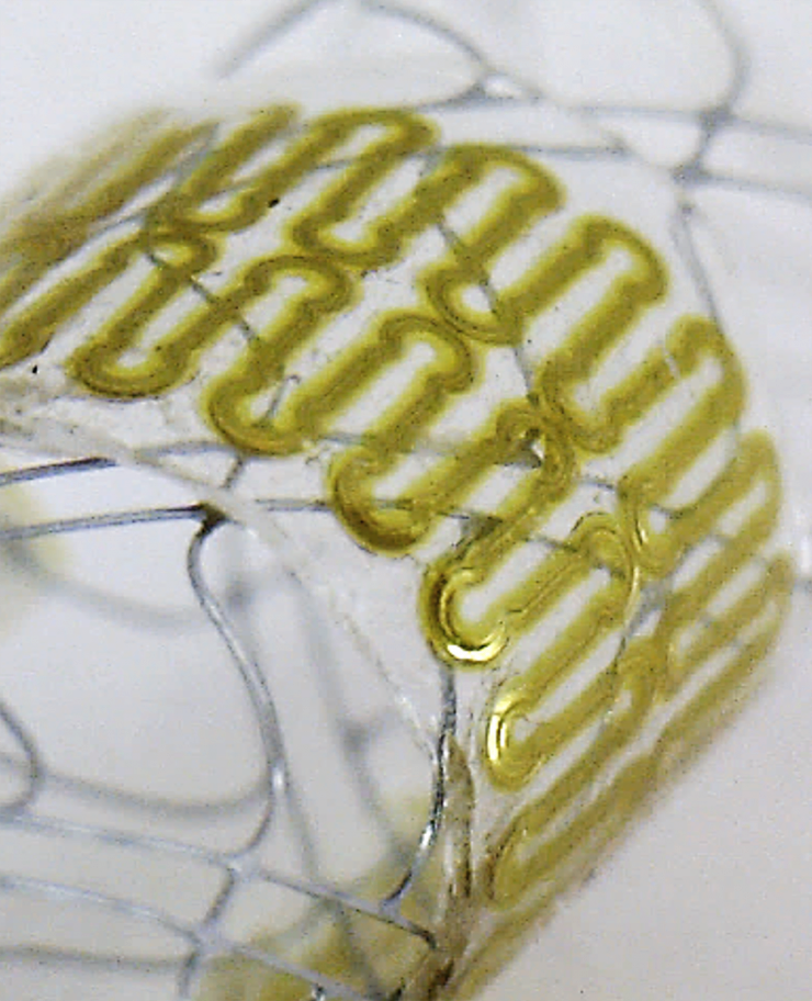 This close-up image shows details of the ultra-thin, low-profile sensor used for monitoring blood flow in the brain. (Georgia Tech Photo) This close-up image shows details of the ultra-thin, low-profile sensor used for monitoring blood flow in the brain. (Georgia Tech Photo)